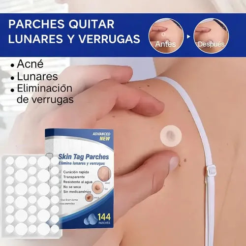 Parche de verrugas - A dios verrugas