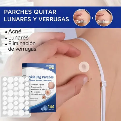 Parche de verrugas - A dios verrugas