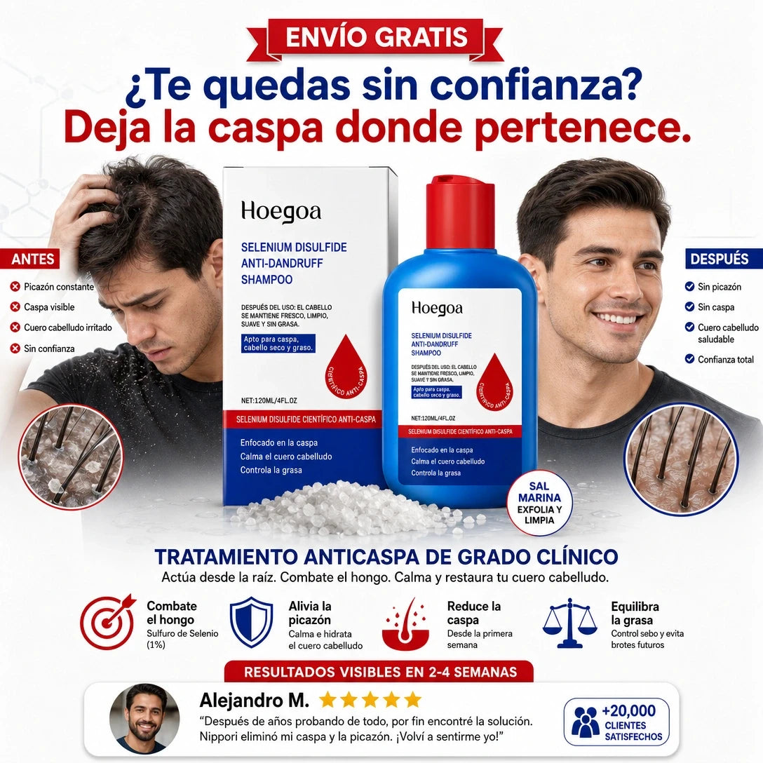Hoegoa | La solución definitiva para la caspa