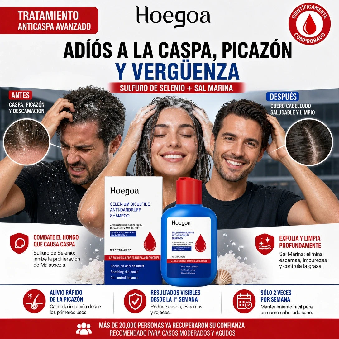 Hoegoa | La solución definitiva para la caspa