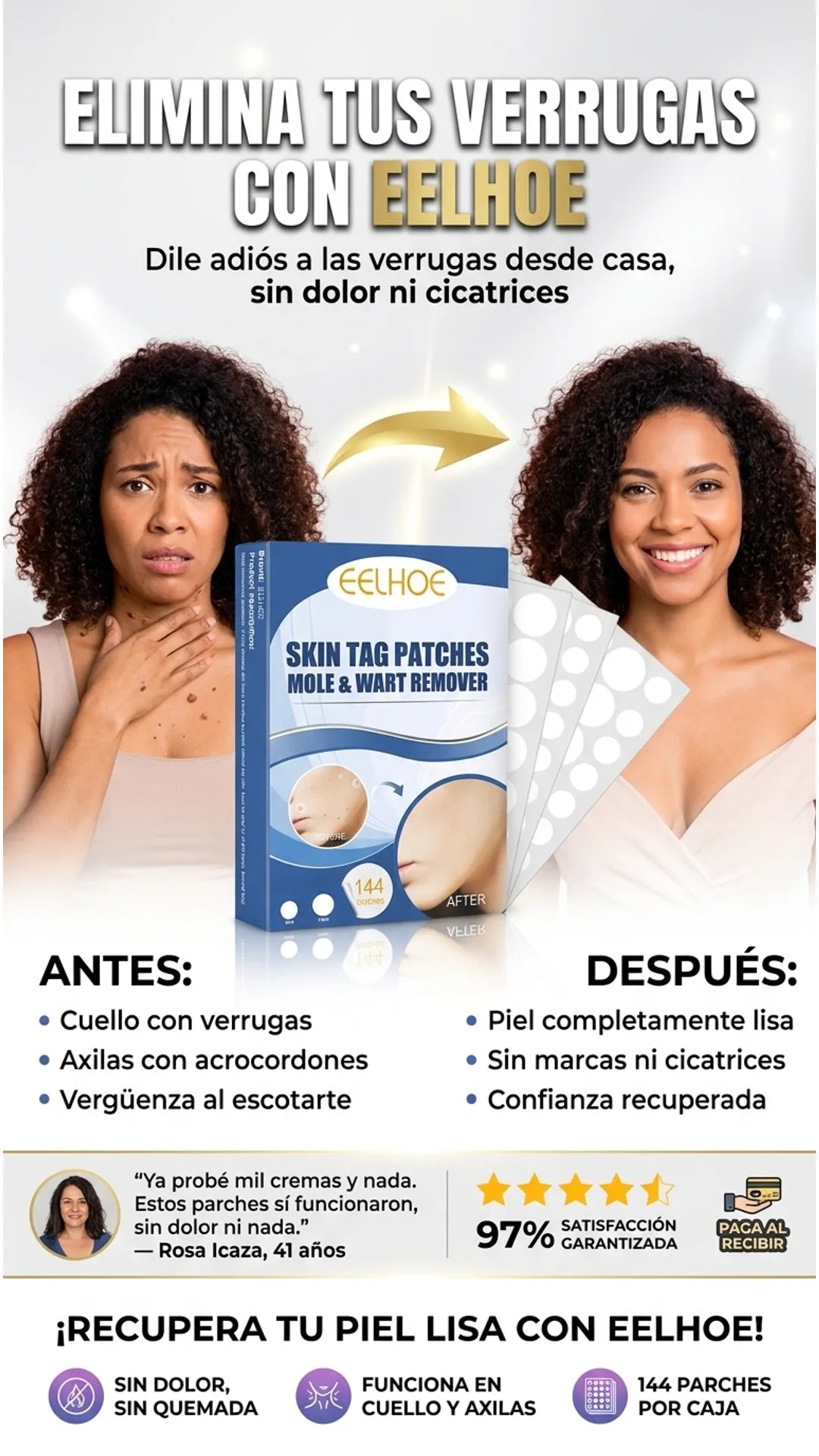 EELHOE — antes-despues