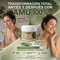 Amu Crem - Adiós Verrugas