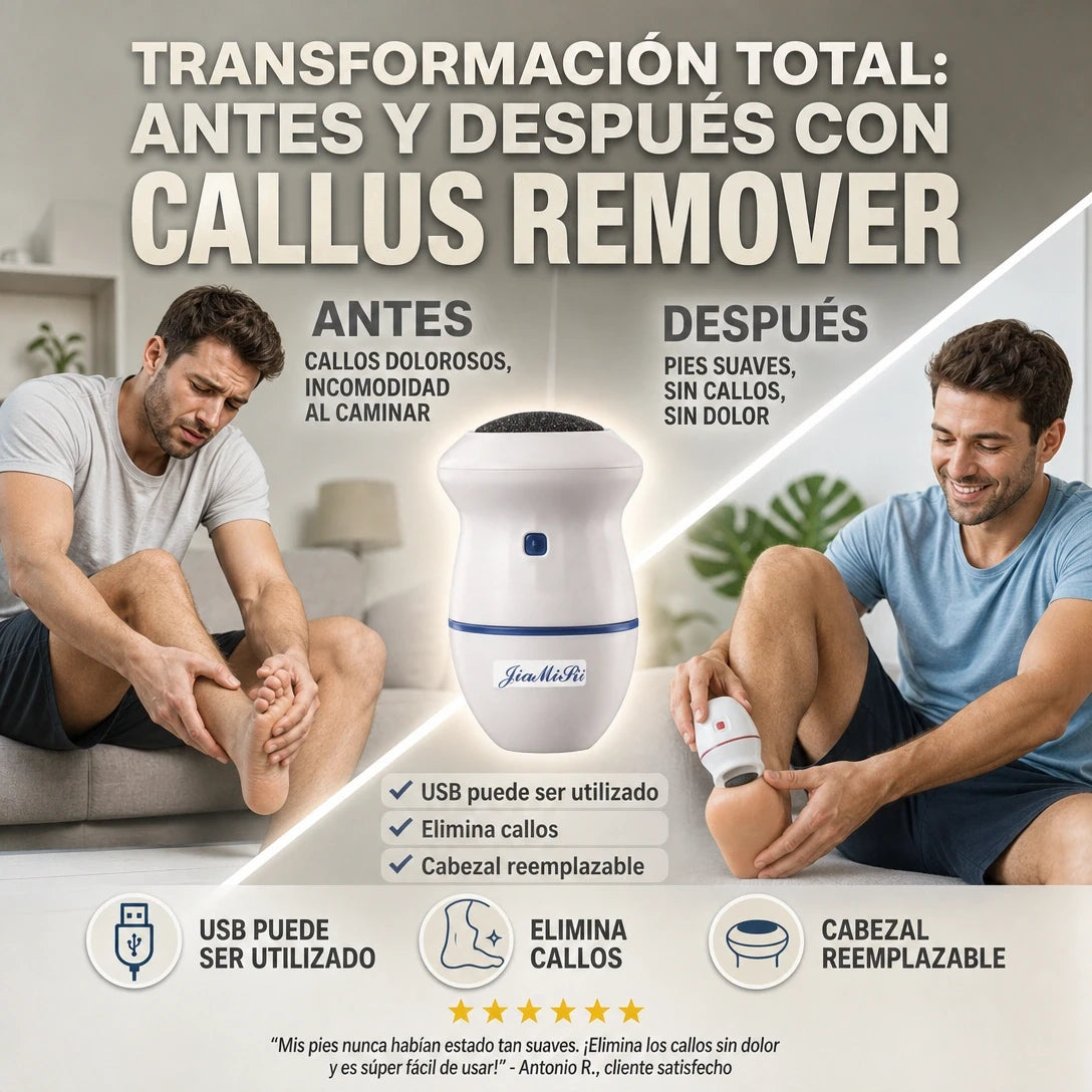Callus - Removedor de callos