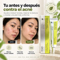 2x1 Retinal - Luce Joven con Tecnología Coreana